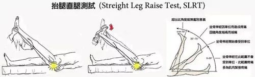 坐骨神经痛的恢复训练正确方法,坐骨神经痛可试试这7个小动作