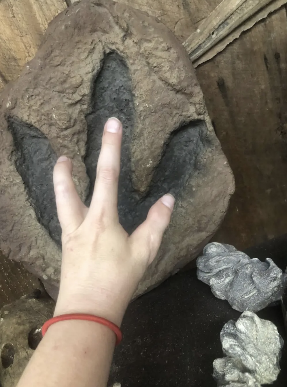 妹子天生只有3根手指，别人说她“霸王龙”，她用乐观狠狠反击！