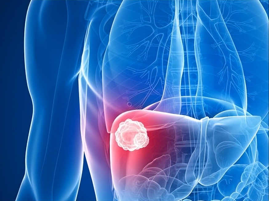 乙肝抗病毒5年肝回声欠均匀,乙肝抗病毒期间肝硬度f2算严重吗