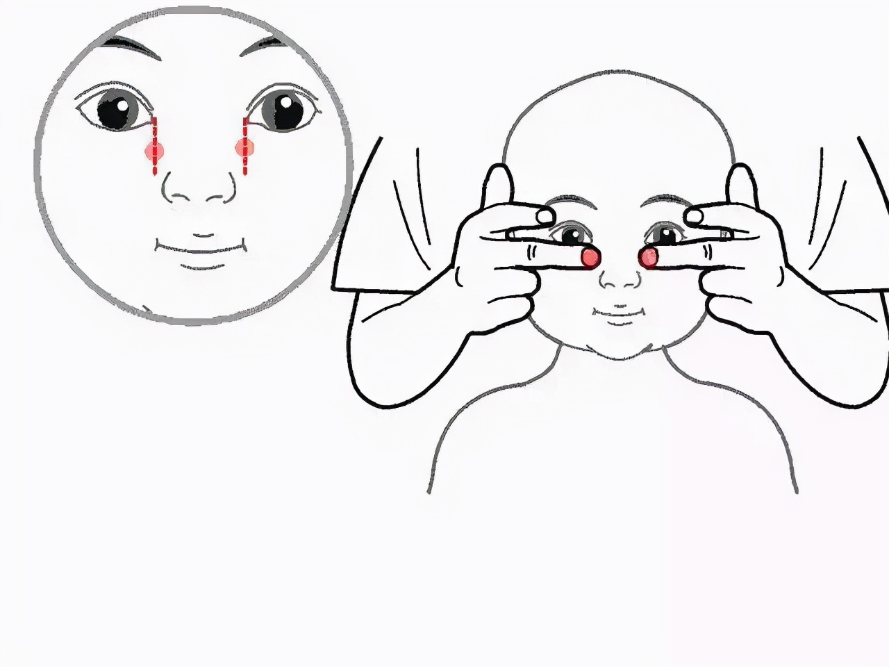 最近接诊近1/4的孩子都有鼻塞鼻痒，今天分享5个改善鼻塞的小妙招