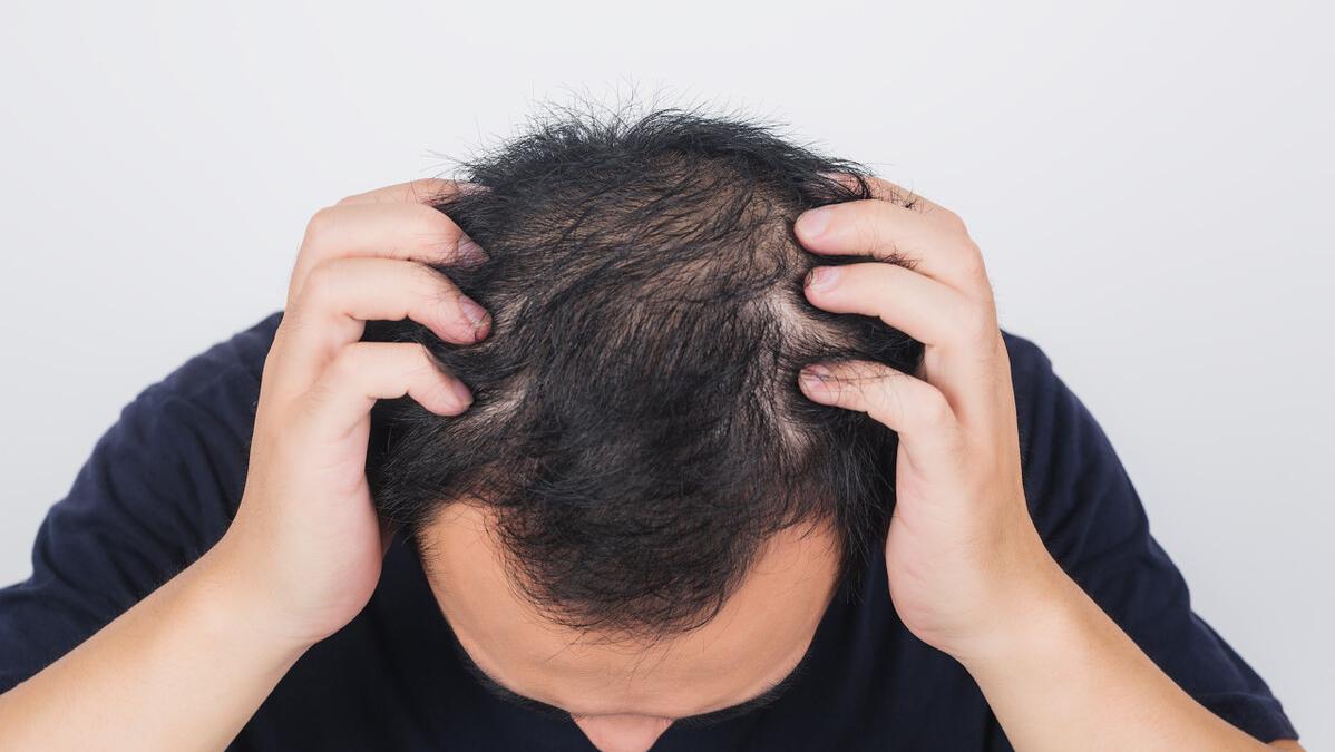 头发越洗越油与洗发水有关,头发越洗油越多的洗发水