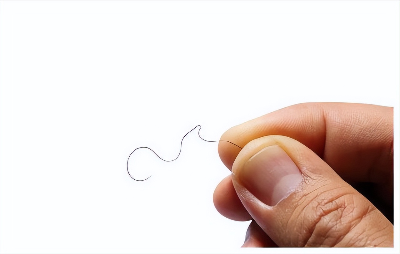 女性毛发容易掉落,什么原因会导致毛发脱落