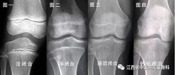 16岁还能有长高的方法吗,17岁有没有快速长高的方法