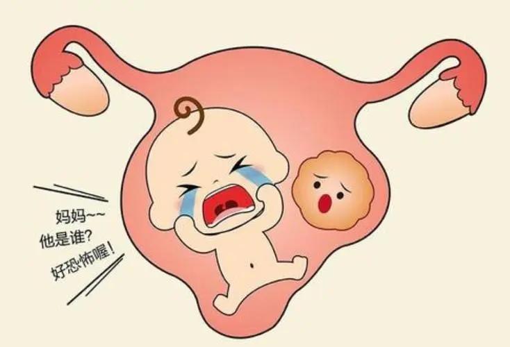 子宫肌瘤从肚脐眼取出,女子子宫内两年取出121枚子宫肌瘤