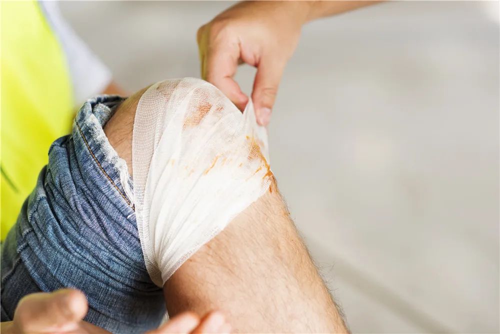 白癜风与伤口变白的区别,伤口变白斑是怎么回事