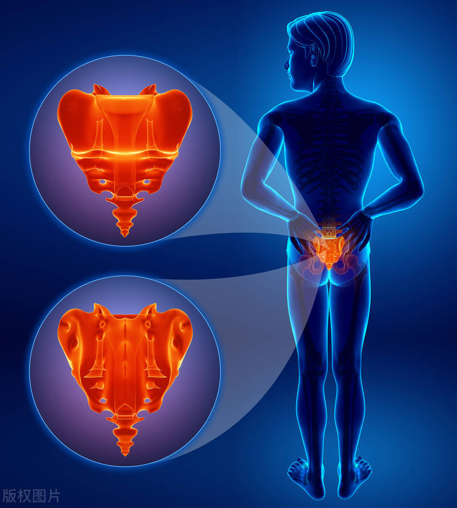 骶管囊肿做什么检查,查出骶管囊肿后尾骨胀