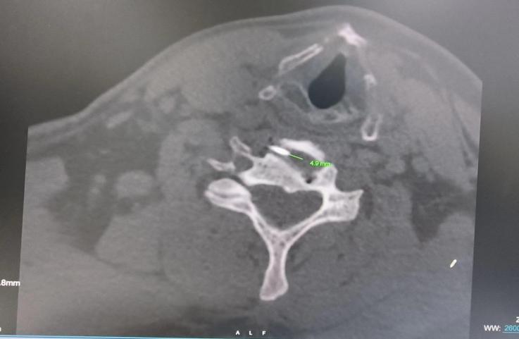 西安市红会医院北院区做微创手术,西安红会医院肌骨超声科