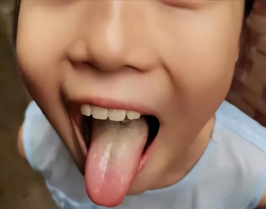 青少年脾胃虚弱瘦怎么调理才有效,小孩脾胃不好偏瘦怎么调理