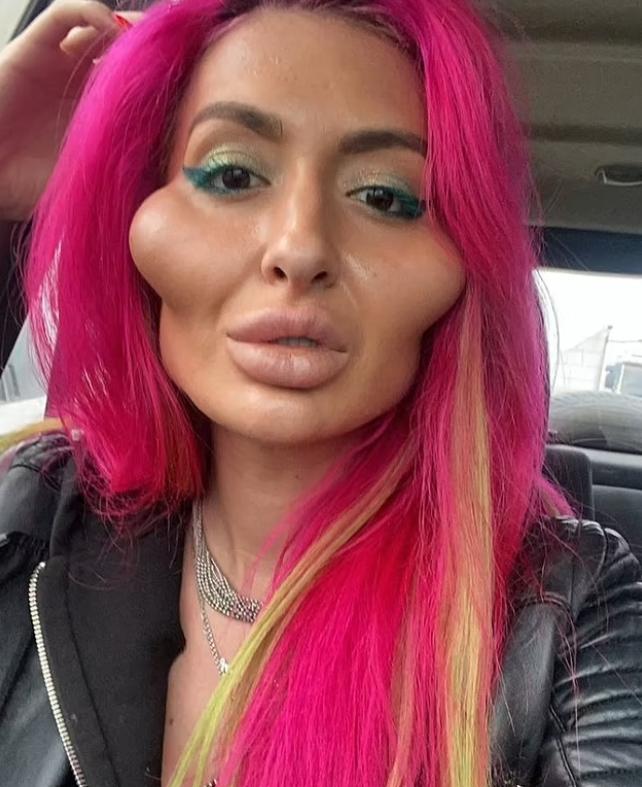 这个动手术打造世界最高颧骨的女人，再次向自己的颧骨下手了