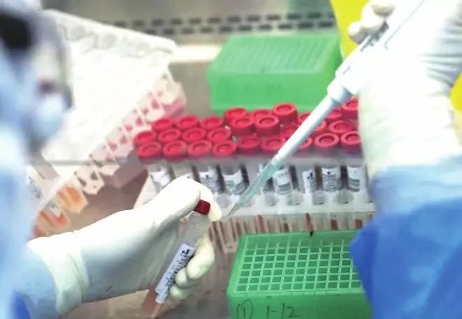 疫情像一面照妖镜,疫情是检验人性的照妖镜