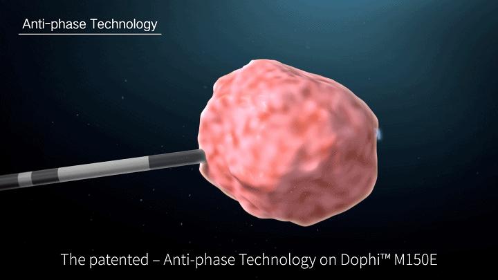 重磅|赛诺微Dophi®M150微波消融仪喜获国家药监局NMPA批准上市