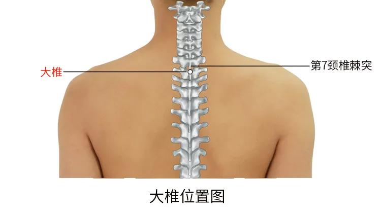 后背长了好多小米粒图片,夏天背上起了很多小米粒