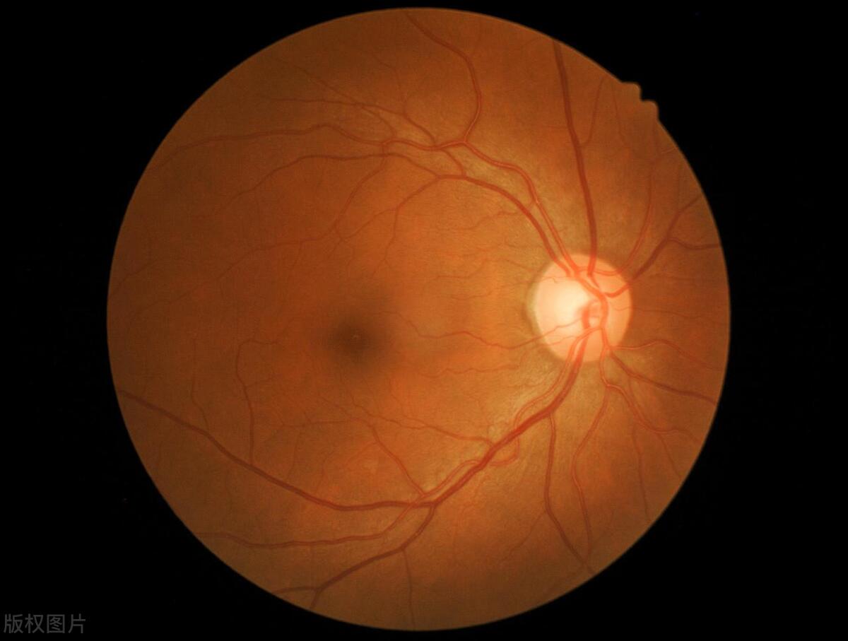 眼睛模糊看不清的一招解决的方法,年龄大眼睛看不清楚模糊怎么办