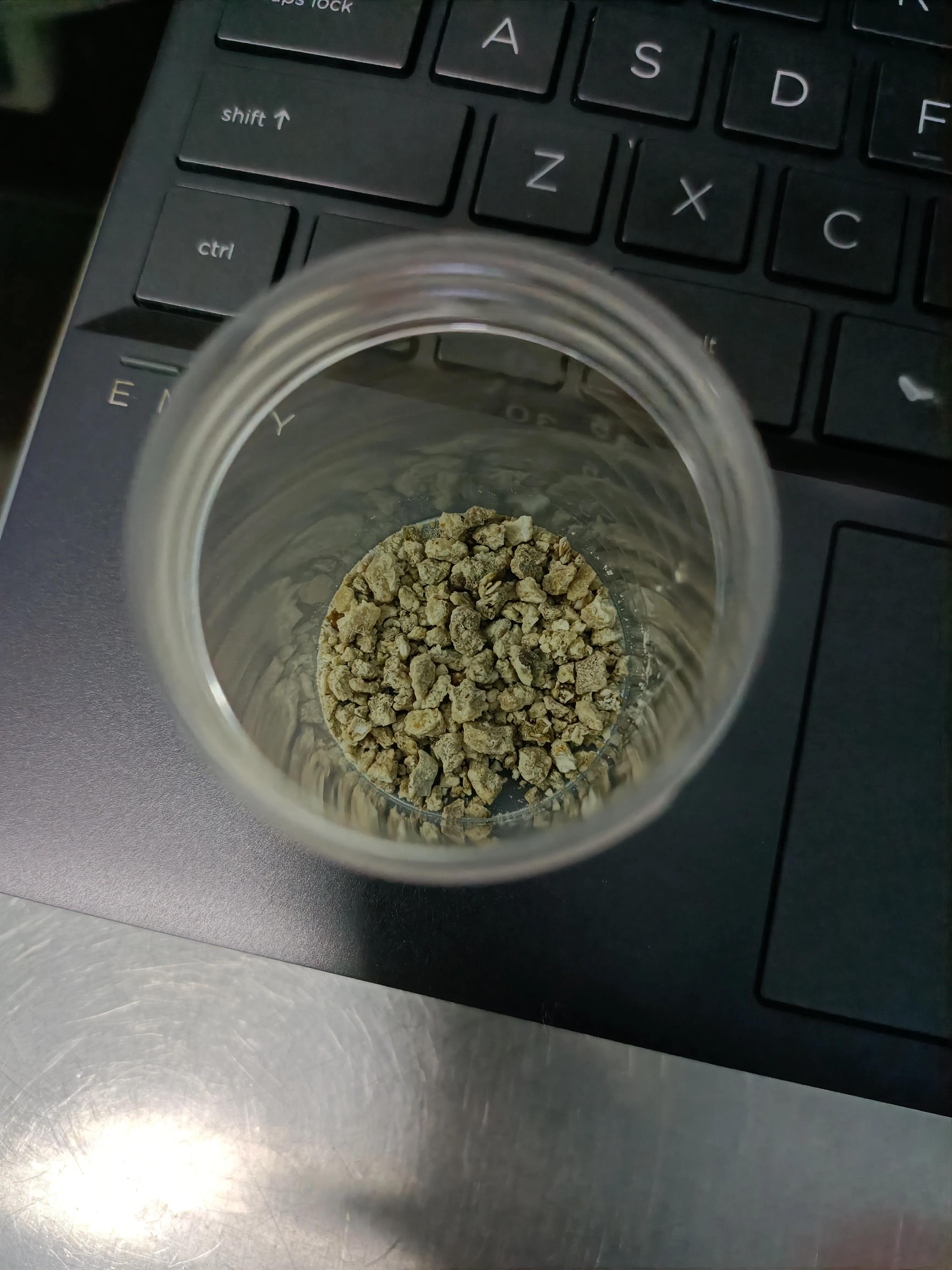 肾结石经皮肾镜两次手术间隔多久,两公分的肾结石需要动几次手术