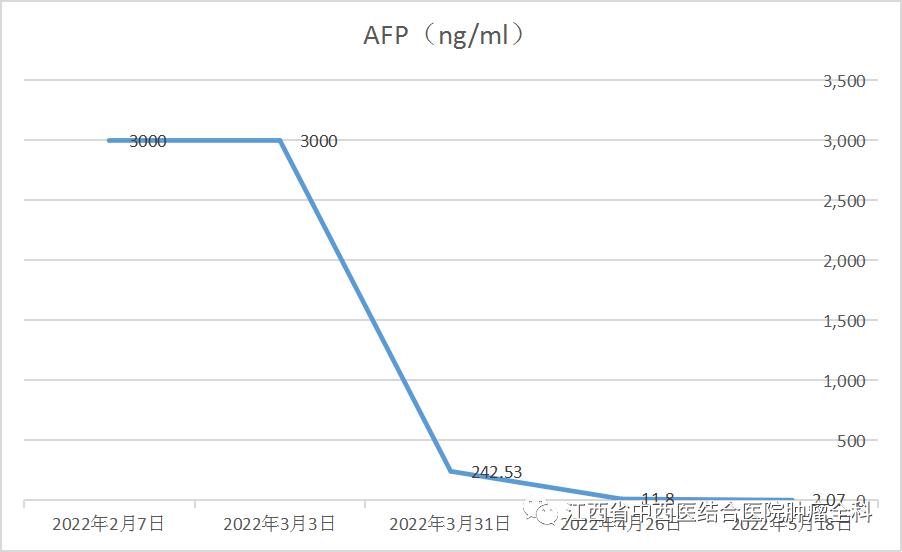 肝癌多发性肝内转移靶向药,肝癌中晚期免疫靶向有奇迹出现吗