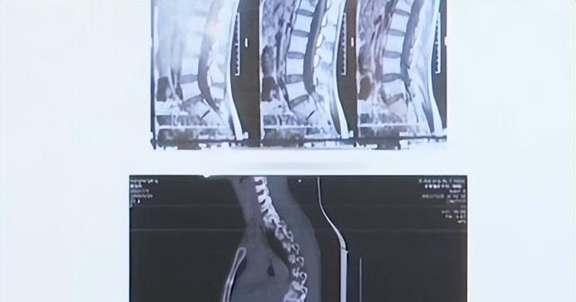 女子乘坐网约车头部受伤,女生乘网约车遇车祸身亡谁担责