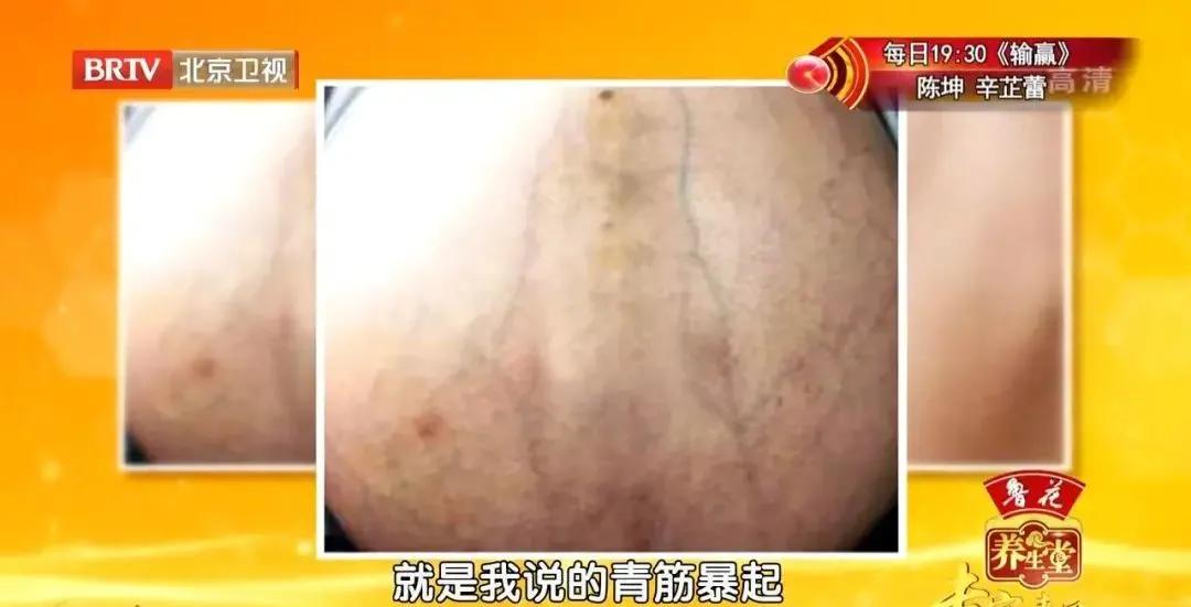 体检查出乳房长了肿瘤,乳房长了小肿瘤一级