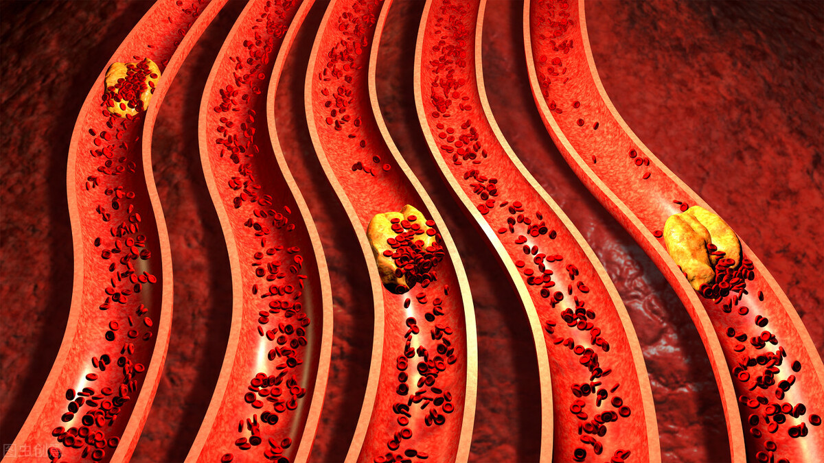 体检显示心率慢意味着什么,体检报告心跳过快