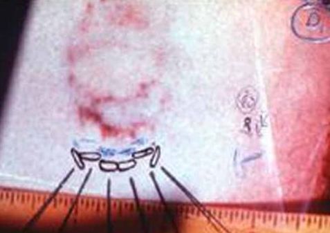 最严重的恋尸癖是欧洲的连环杀手。他杀人的目的是和死人*爱做**。