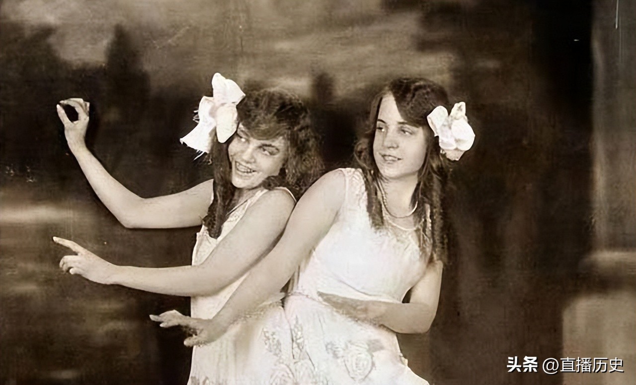 臀部连体姐妹：各有一名丈夫，姐姐死后，妹妹与遗体共存2天去世