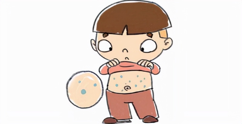 幼儿急性荨麻疹的有效治疗方法,幼儿急性荨麻疹的症状和治疗方法