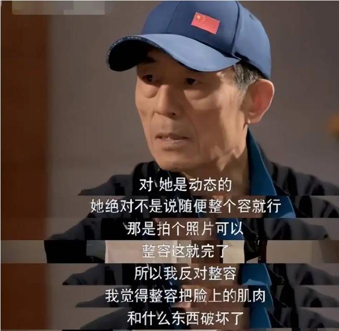 最失败硅胶脸的女星,硅胶脸女明星排行