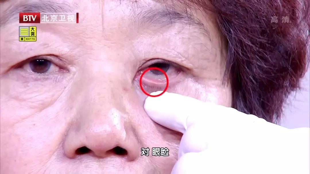 气血不足用什么中药炖鸡蛋,补气血煮鸡蛋喝的方子