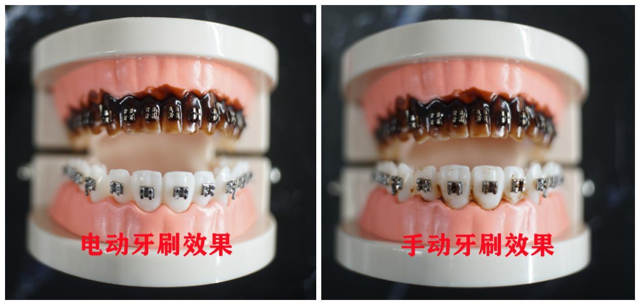 儿童电动牙刷方法不对伤牙齿吗,电动牙刷对儿童的牙齿有什么危害