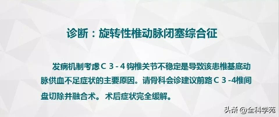 条件反射性眩晕,一种莫名的眩晕