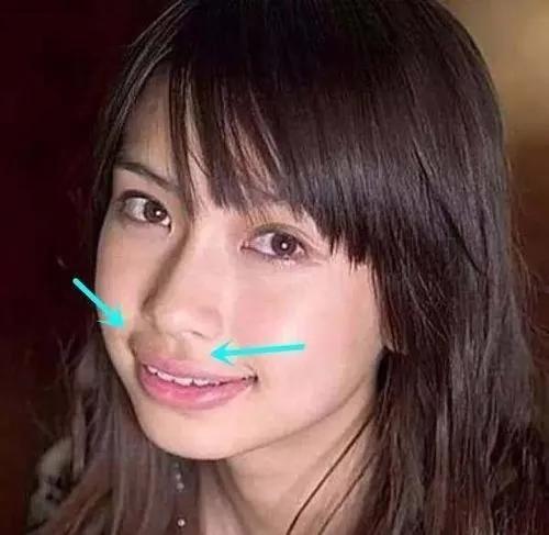 明明是绝顶大美女，却被牙齿拉胯，这15位女星苦不堪言