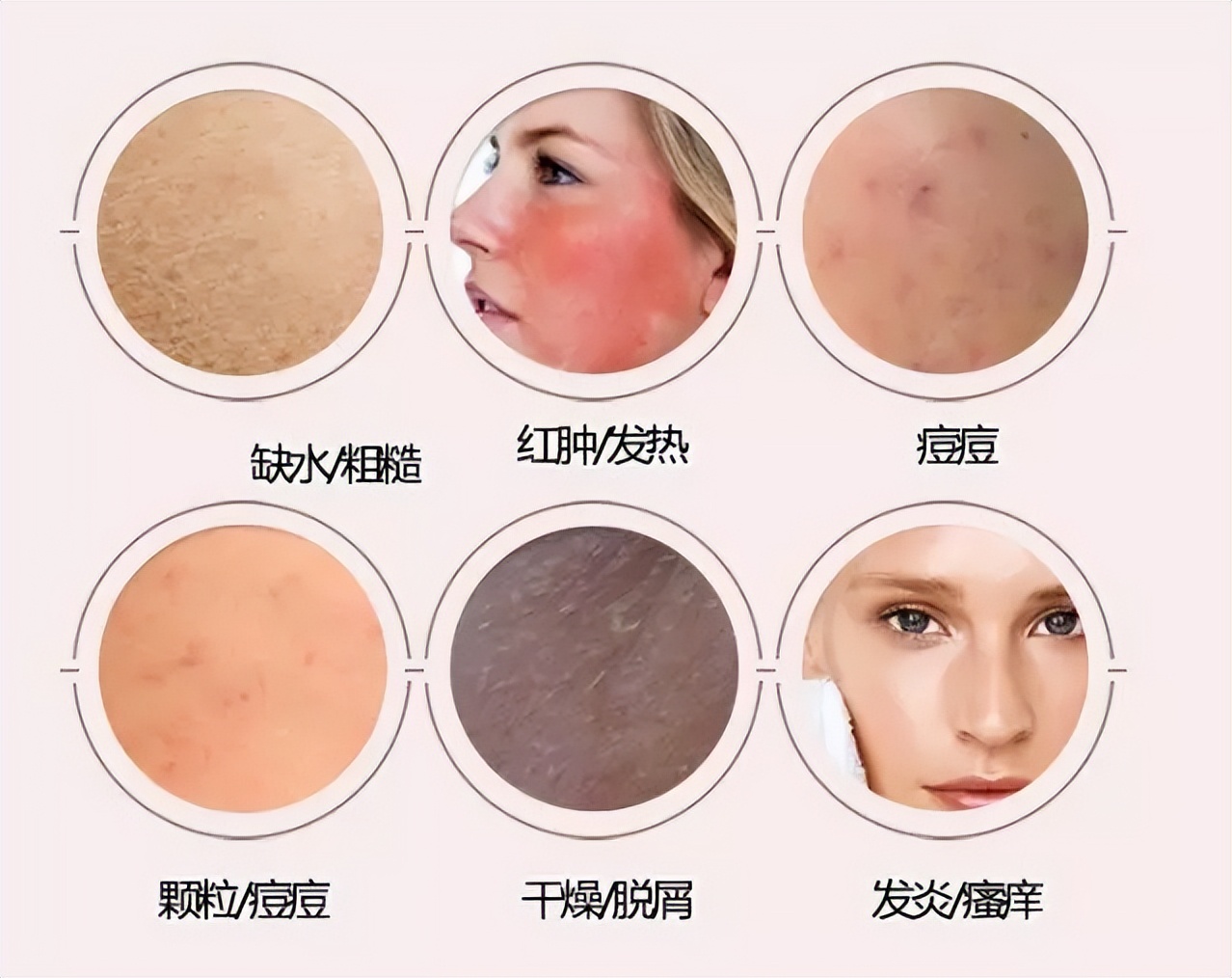 敏感肌脸部过敏最简单的处理方法,如何快速有效缓解脸部过敏