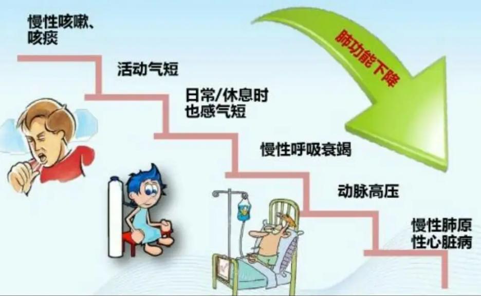 肺气肿病因,肺炎肺气肿