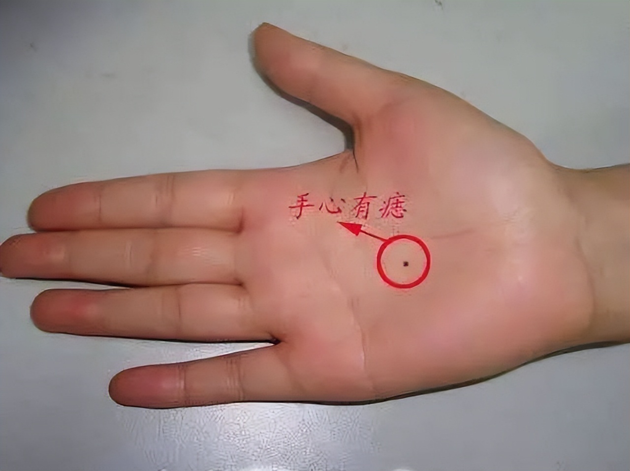 身体部位有黑痣和红痣是什么,痣黑如漆与深黑死痣区别