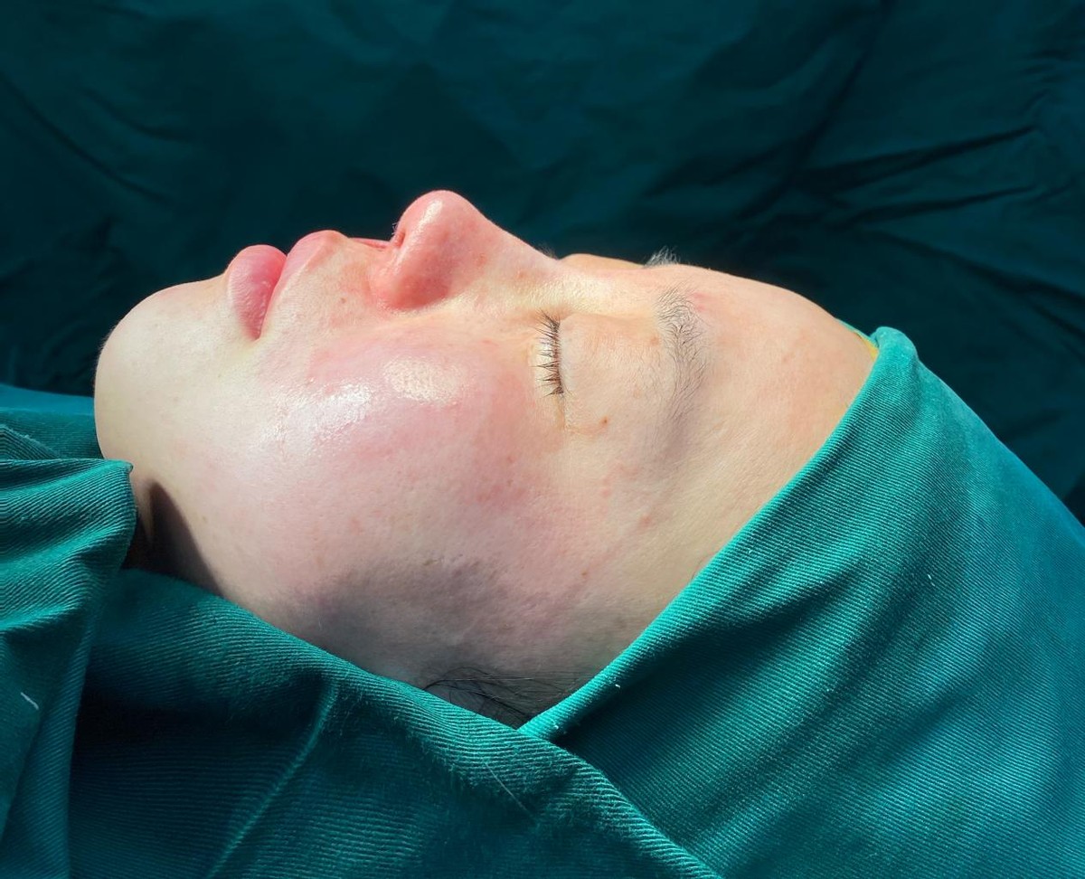 25岁天津女孩,19岁女子瞒着父母去整容