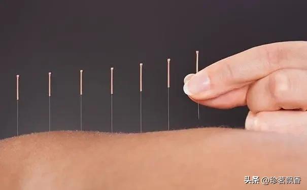 不幸的车祸医生的疏忽疼痛一直相随了我二十余年