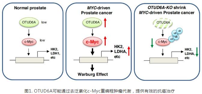 肿瘤研究最新进展前列腺癌,前列腺癌在男性肿瘤发病率排名