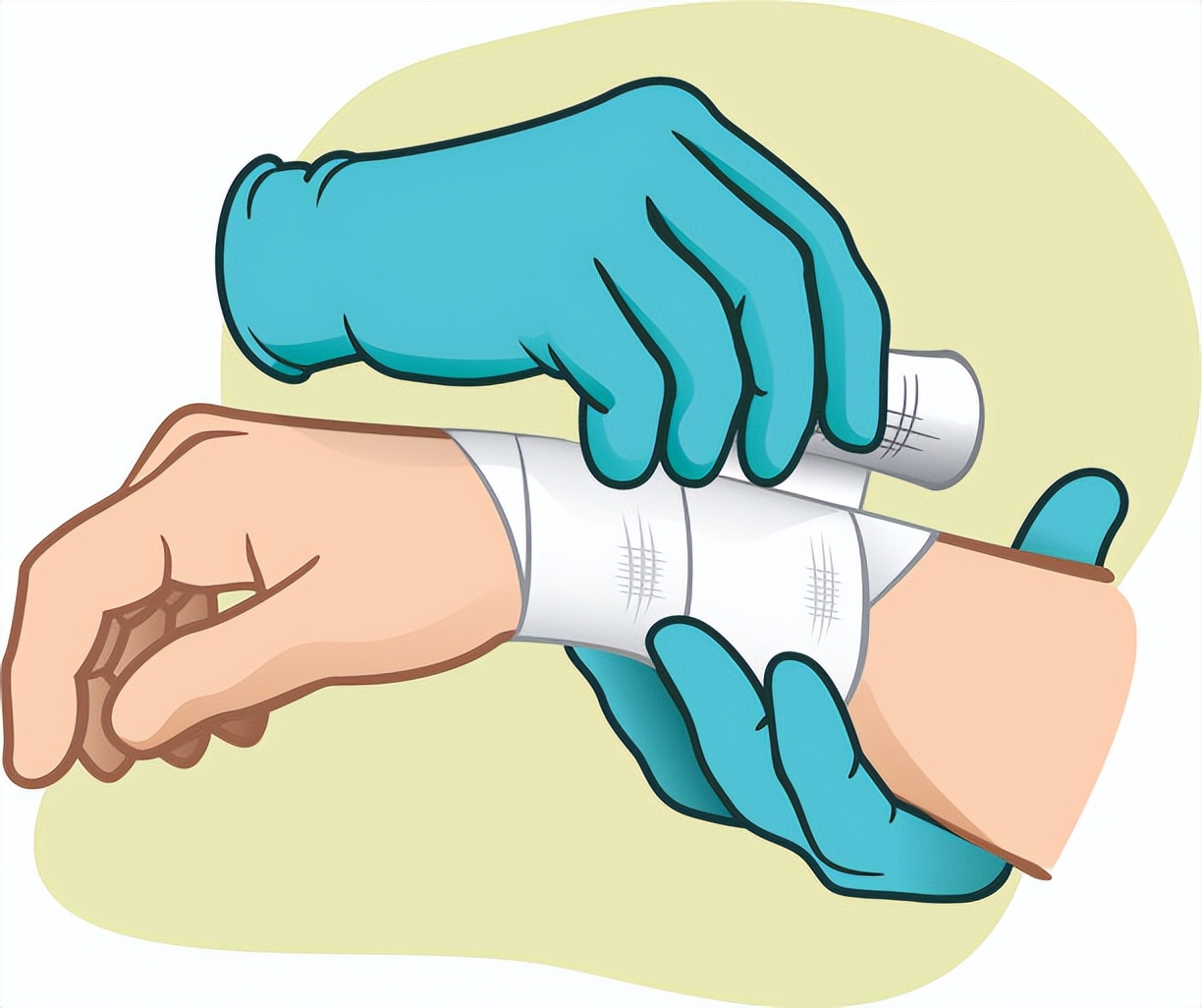 手指被牙签扎了没流血有脓液,手指被扎了一下没有破但是有红点