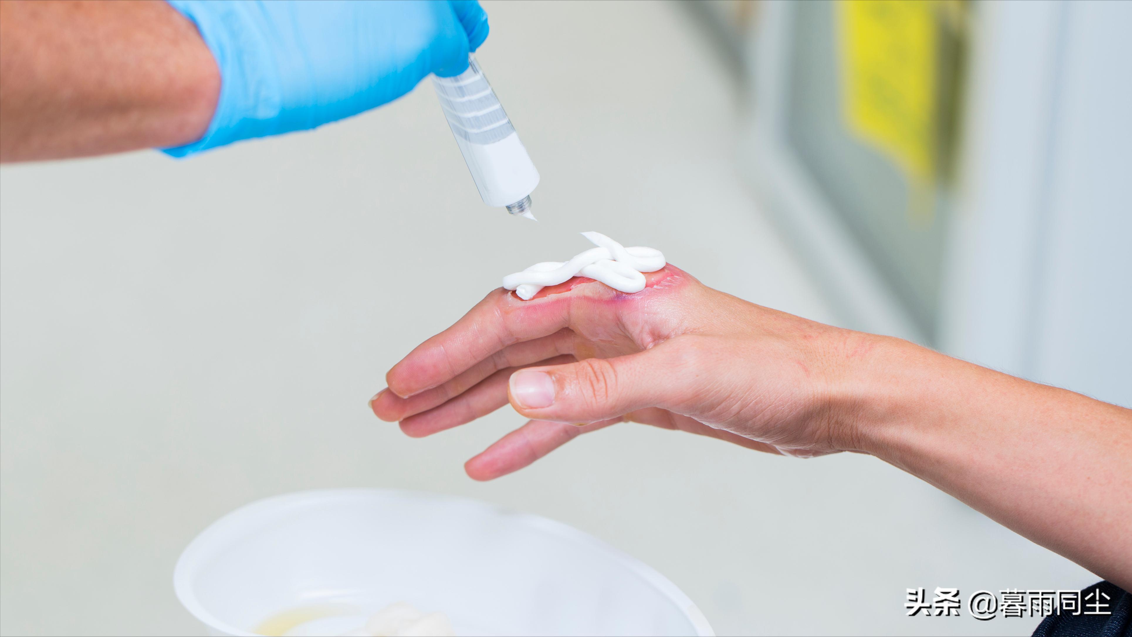 当你遭受核打击时,当受到伤害攻击该如何应对