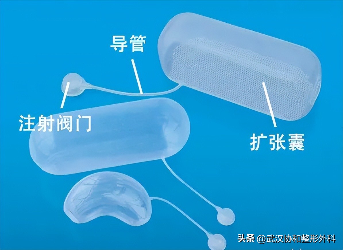 扩张器到底是什么？了解一下