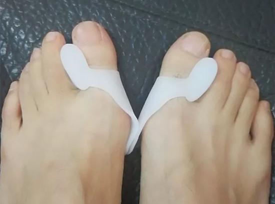 矫正拇指外翻的神器哪种好,矫正拇外翻的工具购买