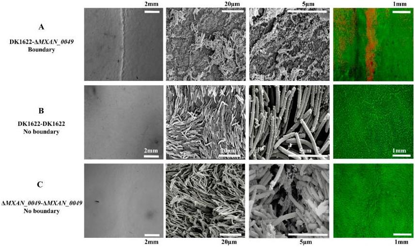 蛋白质组学基因组学转录组学,蛋白质组学在肿瘤的应用