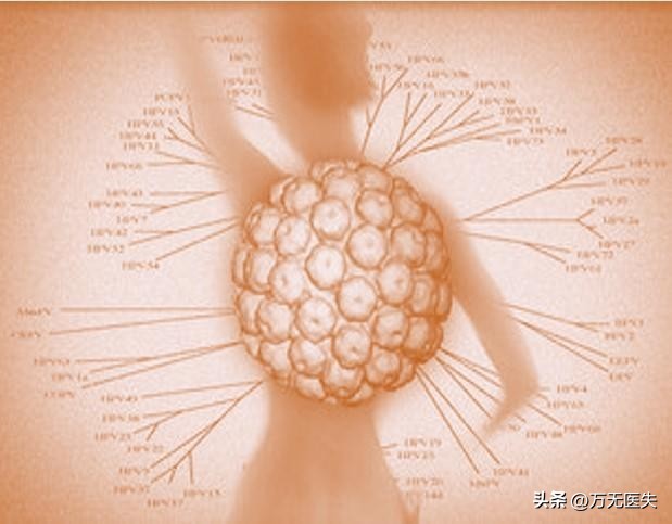 50岁女性患外阴癌,后悔不已!警示女性:出现下身不舒服,别忽略