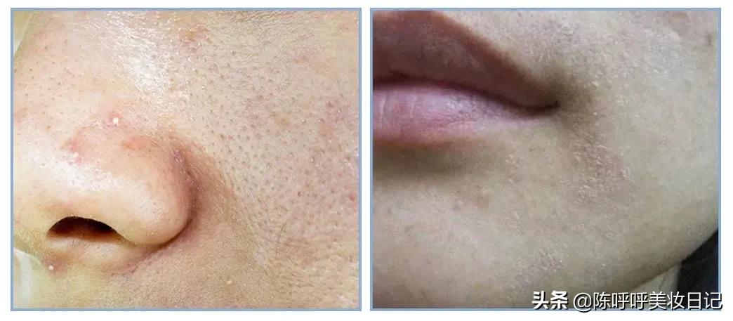 怎样使用精华液达到最佳护肤效果,精华液在哪一步使用效果最好