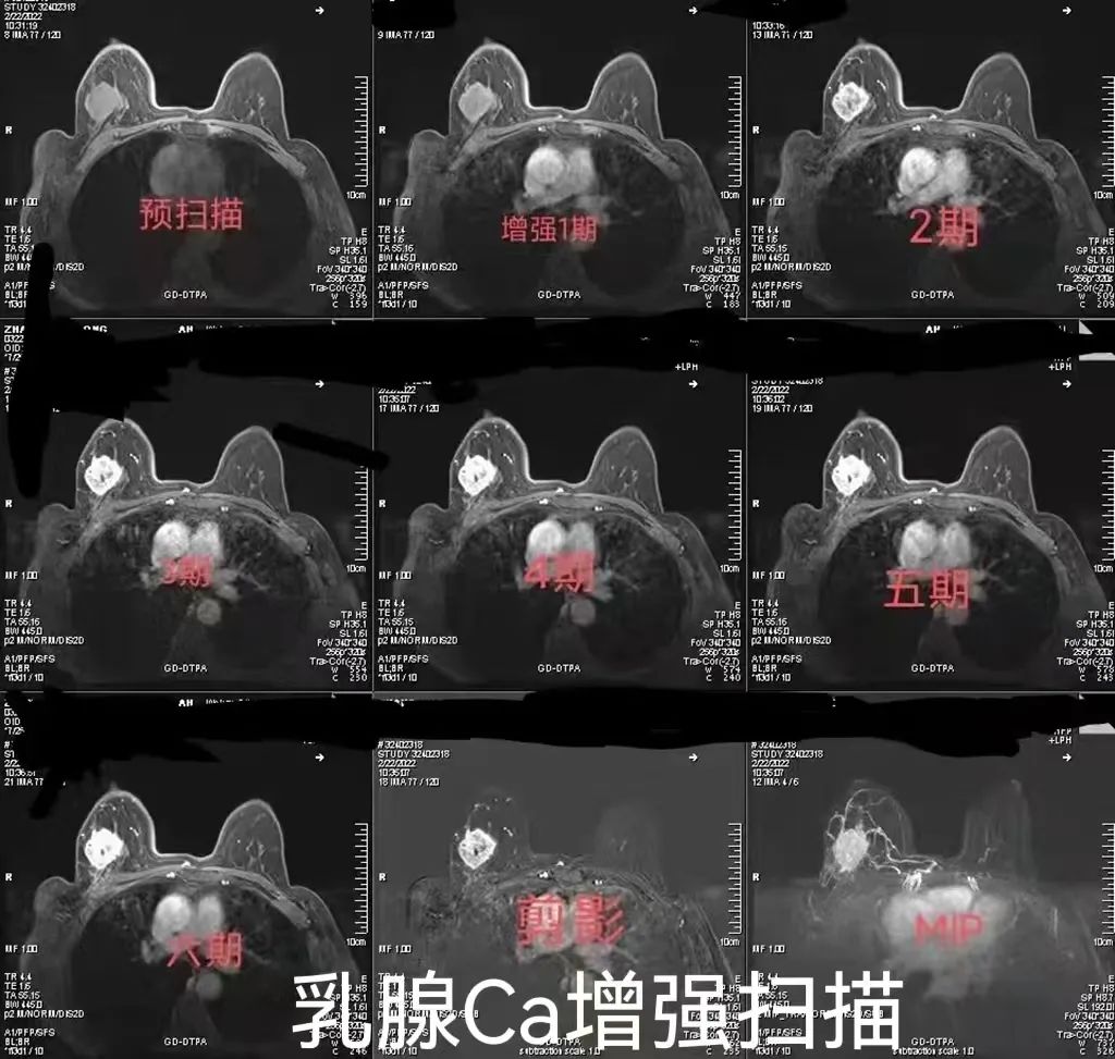 致敬公司的摄影师,美女致敬摄影师视频