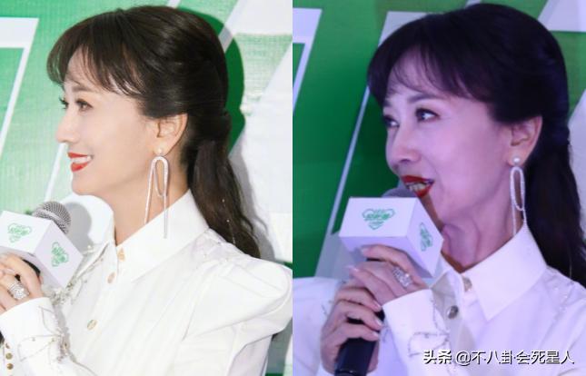 颈纹越来越多越来越显老怎么办,顽固又显老的颈纹