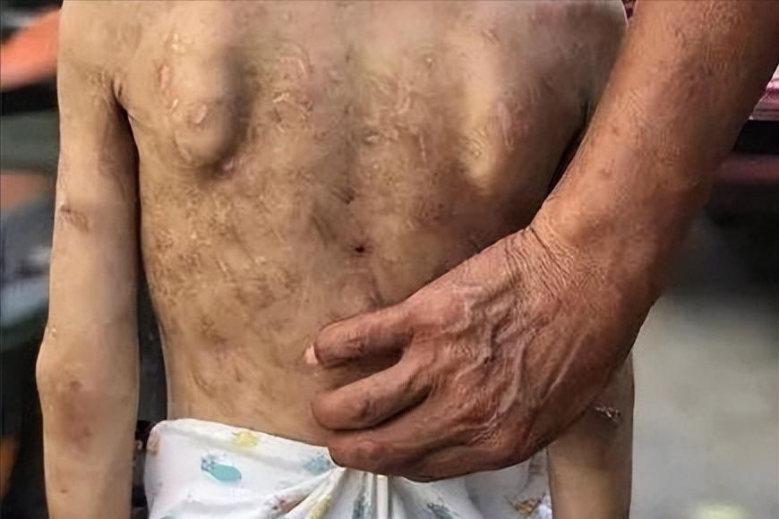 小女孩疑遭父母当街残忍虐待后续,虐待殴打儿童家庭暴力事件