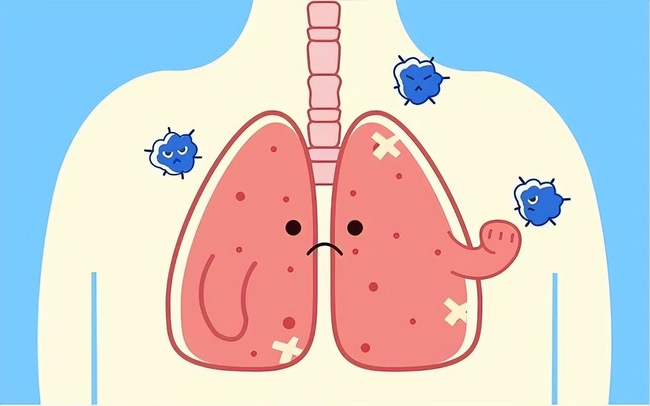 专家谈慢阻肺病管理目标,慢阻肺健康宣教感言