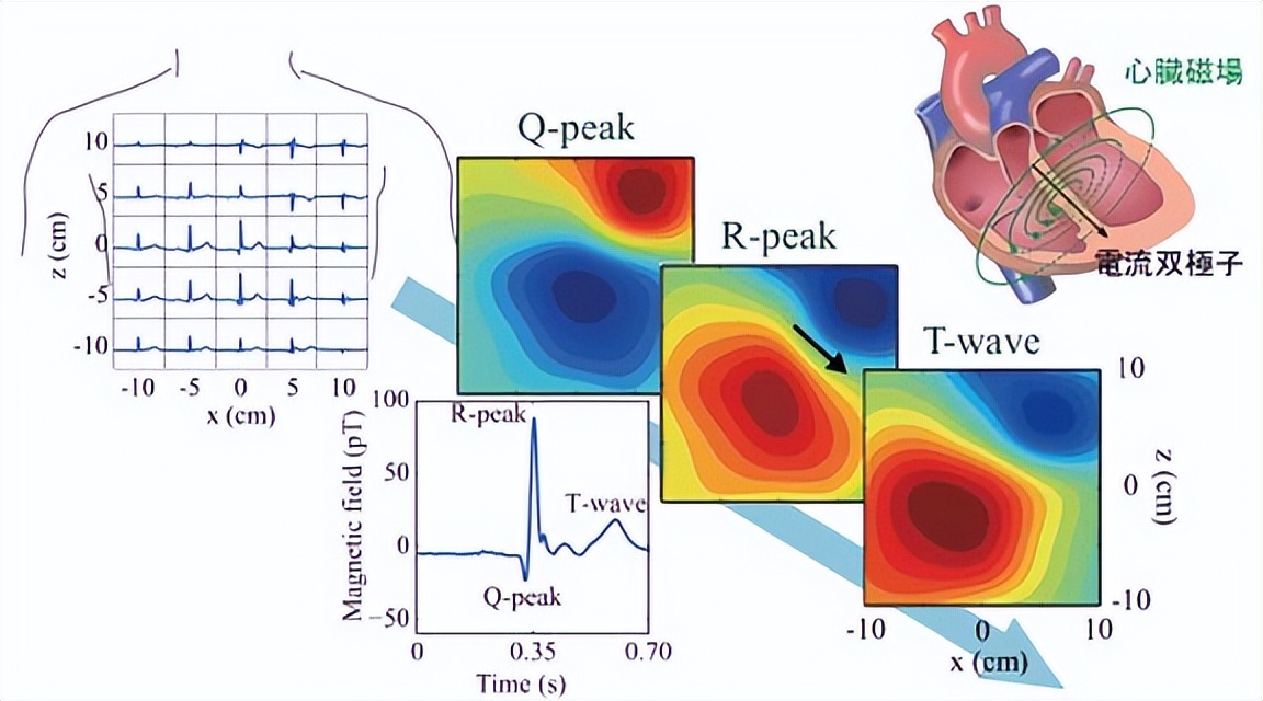 急性心包炎什么原因引起的,急性心包炎的可能性是什么意思