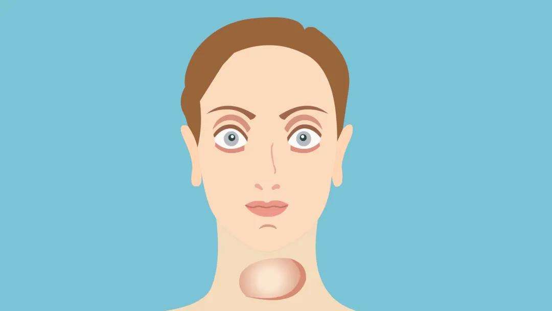 甲状腺调理新方案家康,调理甲状腺亢进