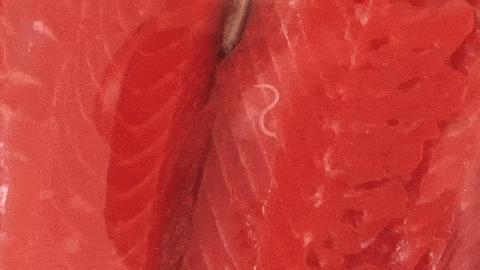 体内有绦虫吃什么食物,女子体内排出4.59米长的绦虫